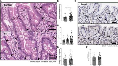 Type 2 and type 17 effector cells are increased in the duodenal mucosa but not peripheral blood of patients with functional dyspepsia